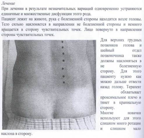 Латеральные чувствительные к боли точки ТЫ до L2 - student2.ru