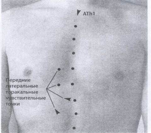 Латеральные чувствительные к боли точки ТЫ до L2 - student2.ru