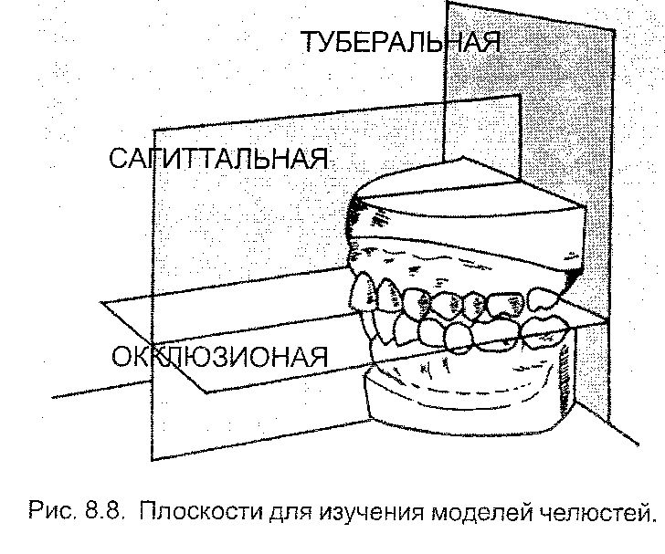 Методики биометрического измерения гипсовых моделей челюстей - student2.ru