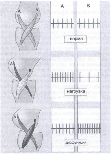 Ноцицептивная подача и мышечный тонус - student2.ru