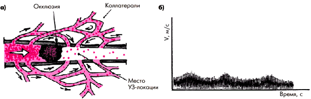 Определение коэффициента атерогенности - student2.ru