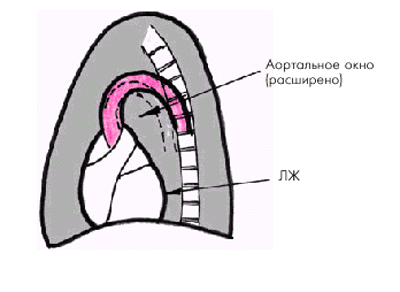 Определение коэффициента атерогенности - student2.ru