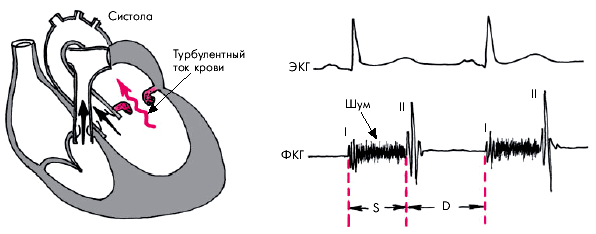 Осмотр и пальпация сердца - student2.ru