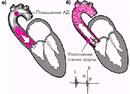 Осмотр, пальпация и перкуссия сердца - student2.ru