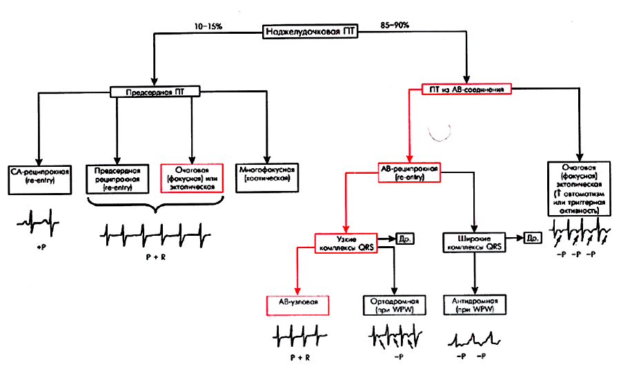 Пароксизмальные наджелудочковые (суправентрикулярные) тахикардии - student2.ru
