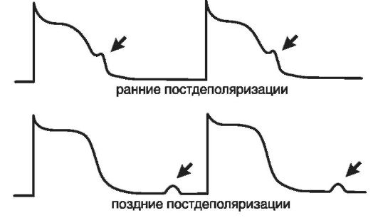 Патогенез нарушений сердечного ритма - student2.ru