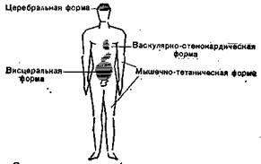 Первичный гиперпаратиреоз - student2.ru