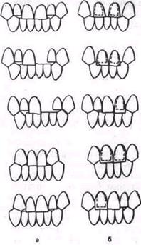 Повреждение временных и постоянных зубов - student2.ru