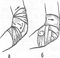 Правила наложения бинтовых повязок - student2.ru