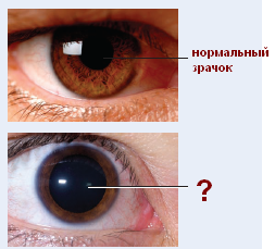 ПРОВЕДИТЕ АНАЛИЗ ИТОГОВ РАБОТЫ. Инфекционно – аллергическое заболевание рассеянный склероз - student2.ru