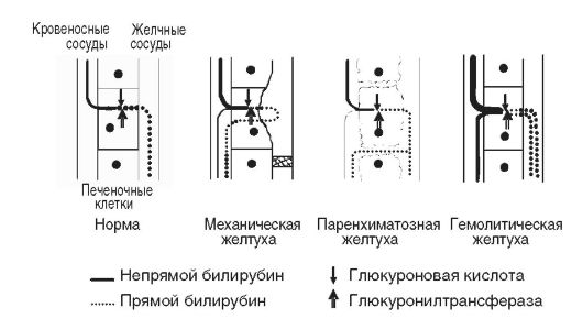 Сопровождающийся повышенной концентрацией желчных компонентов в сыворотке крови и в некоторых биологических жидкостях - student2.ru