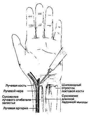 В. Методика выполнения блокады - student2.ru