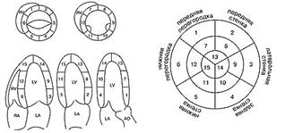 возможности эхокардиографии в диагностике ибс и ее осложнений - student2.ru