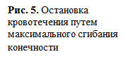 Временная остановка артериального кровотечения максимальным сгибанием конечности - student2.ru