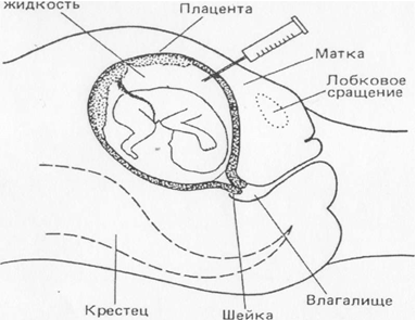 II. Характеристика основных методов генетики человека с основами медицинской генетики - student2.ru