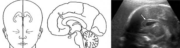 основные принципы диагностики врожденных пороков развития - student2.ru