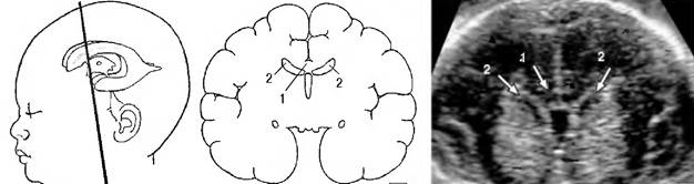 основные принципы диагностики врожденных пороков развития - student2.ru