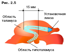 арсенал долговременной памяти - student2.ru