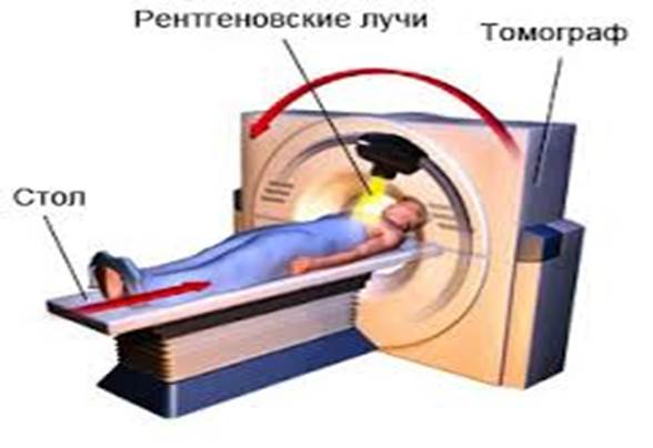 Компьютерлік томография (КТ). - student2.ru