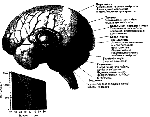 Возрастные изменения мозговой ткани - student2.ru