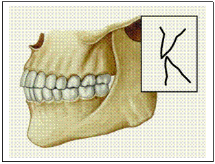 Text I. Occlusal interferences and occlusal harmony - student2.ru