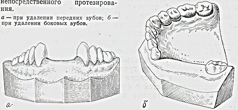 Адаптация к пластиночным протезам - student2.ru