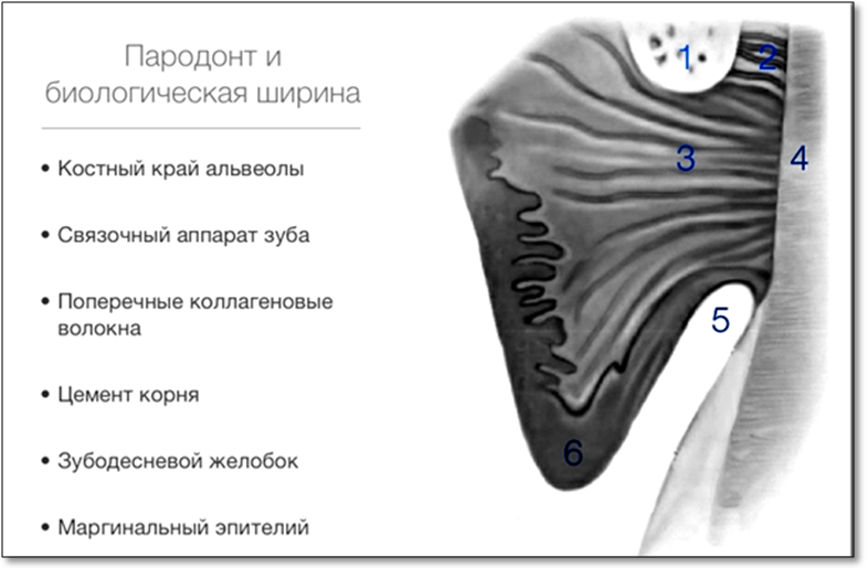 Финишная обработка уступа и осевых стенок культи. - student2.ru