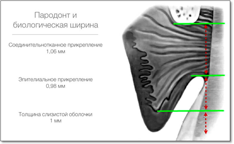 Финишная обработка уступа и осевых стенок культи. - student2.ru