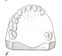 Классификация дефектов зубного ряда по Кеннеди - student2.ru