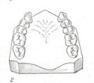 Классификация дефектов зубного ряда по Кеннеди - student2.ru