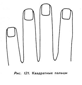 мизинец, безымянный, средний и указательный пальцы - student2.ru