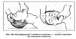 Наружный массаж сердца. Искусственная вентиляция лёгких - student2.ru