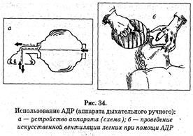 Наружный массаж сердца. Искусственная вентиляция лёгких - student2.ru