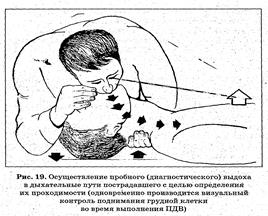 Наружный массаж сердца. Искусственная вентиляция лёгких - student2.ru