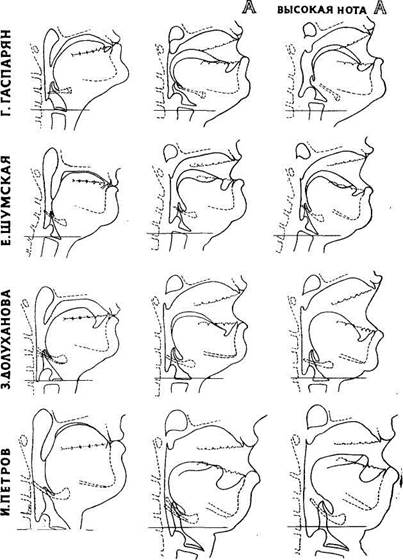 Научные данные о положении гортани во время пения - student2.ru