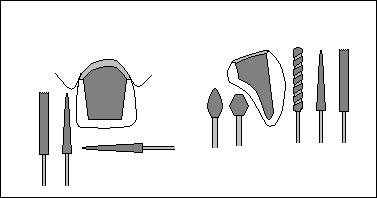 Одонтопрепарирование под искусственные коронки - student2.ru