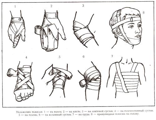 Правила наложения повязок - student2.ru