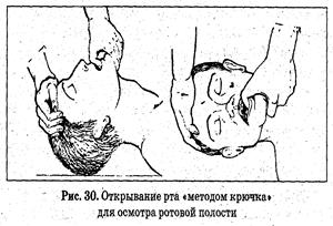 Причины непроходимости дыхательных путей и способы их устранения - student2.ru