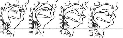 Рентгенологические наблюдения за артикуляцией у певцов - student2.ru