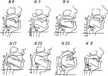 Рентгенологические наблюдения за артикуляцией у певцов - student2.ru