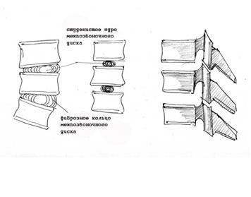 Тема 3. Торс. Костная основа. Устройство позвоночника, кифоз, лордос - student2.ru