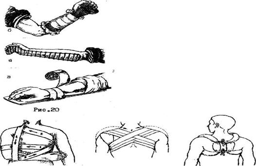 Транспортная иммобилизация при повреждении верхних конечностей и плечевого пояса - student2.ru