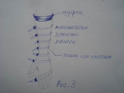 Дальнейшее развитие метода – гидросистема - student2.ru