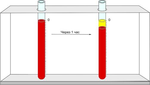 II. 4. Скорость оседания эритроцитов (СОЭ) - student2.ru