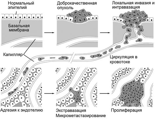 Механизмы инвазии, неоангиогенеза и метастазирования - student2.ru