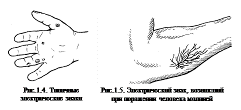 Местные электротравмы - student2.ru