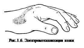 Местные электротравмы - student2.ru