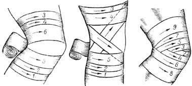 Наложение повязок при различных ранениях - student2.ru