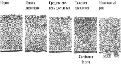 Наследственные новообразования - student2.ru