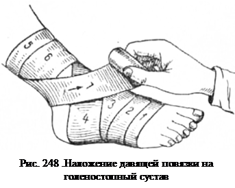 первая помощь при переломах костей - student2.ru